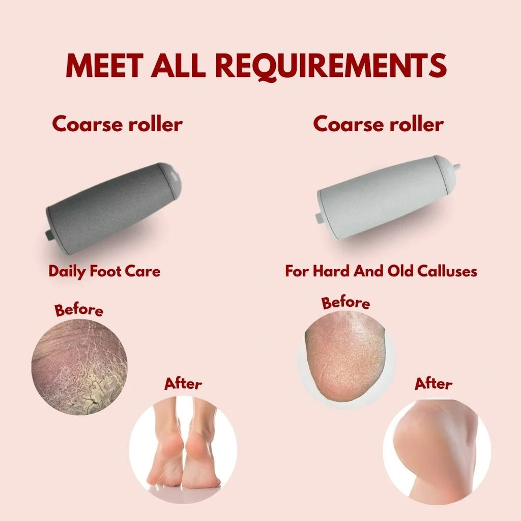 Electric Foot Callus Remover