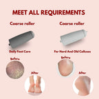 Electric Foot Callus Remover
